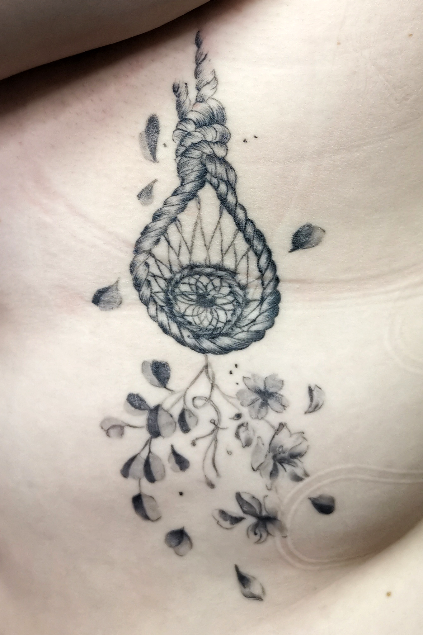 noeud_pendu_healed